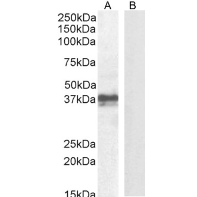 Western Blot - Anti-FOXI3 Antibody (A84944) - Antibodies.com