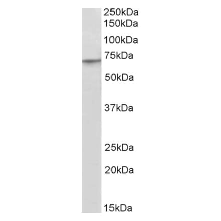 Western Blot - Anti-PRDM14 Antibody (A84945) - Antibodies.com