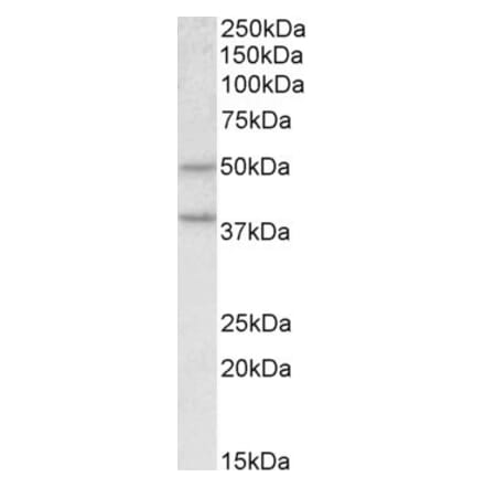 Western Blot - Anti-MBOAT4 Antibody (A84949) - Antibodies.com