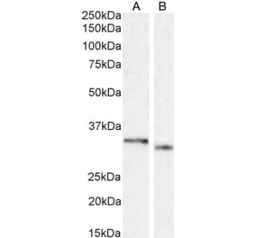 Western Blot - Anti-PIM2 Antibody (A84951) - Antibodies.com