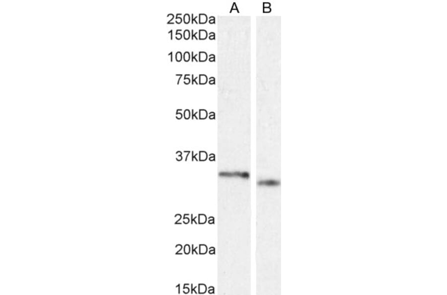 Western Blot - Anti-PIM2 Antibody (A84951) - Antibodies.com
