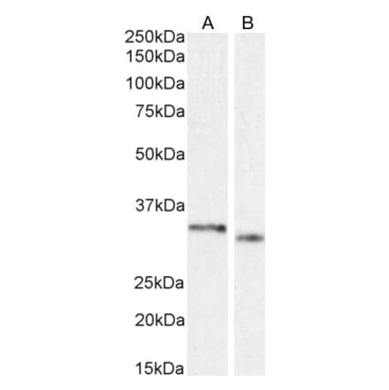 Western Blot - Anti-PIM2 Antibody (A84951) - Antibodies.com