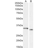 Western Blot - Anti-PIM2 Antibody (A84951) - Antibodies.com