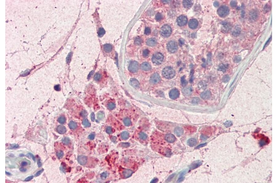 Immunohistochemistry - Anti-PIM2 Antibody (A84951) - Antibodies.com