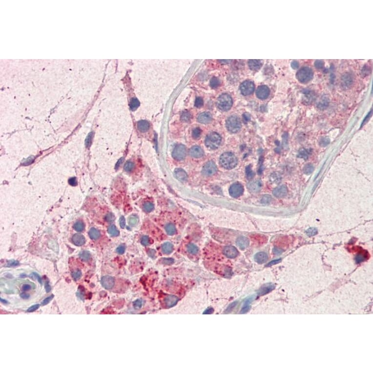 Immunohistochemistry - Anti-PIM2 Antibody (A84951) - Antibodies.com