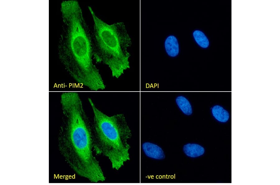 Immunofluorescence - Anti-PIM2 Antibody (A84951) - Antibodies.com