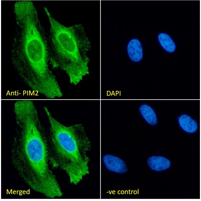 Immunofluorescence - Anti-PIM2 Antibody (A84951) - Antibodies.com