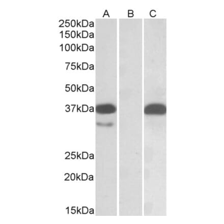 Western Blot - Anti-PIM2 Antibody (A84951) - Antibodies.com