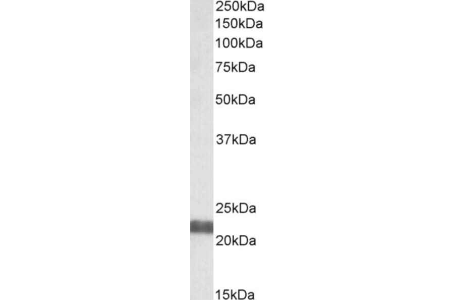 Western Blot - Anti-NCE2/UBE2F Antibody (A84952) - Antibodies.com