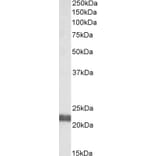 Western Blot - Anti-NCE2/UBE2F Antibody (A84952) - Antibodies.com