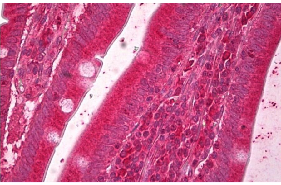 Immunohistochemistry - Anti-ERO1L Antibody (A84956) - Antibodies.com