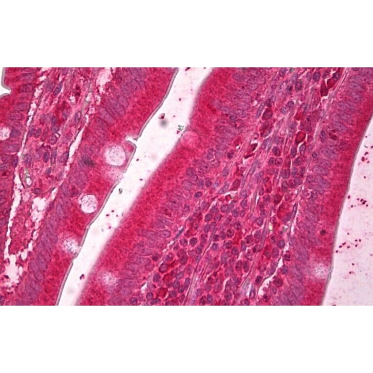 Immunohistochemistry - Anti-ERO1L Antibody (A84956) - Antibodies.com