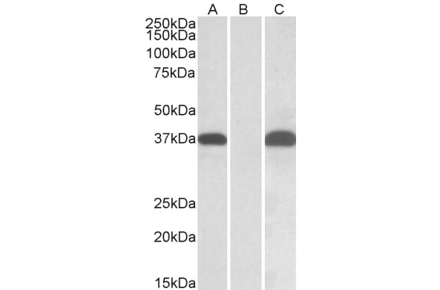 Western Blot - Anti-PIM2 Antibody (A84957) - Antibodies.com