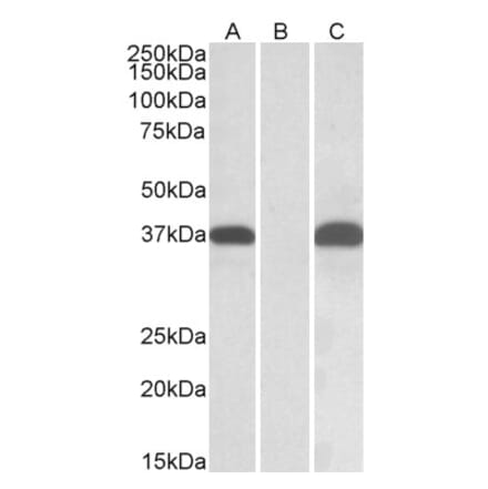 Western Blot - Anti-PIM2 Antibody (A84957) - Antibodies.com