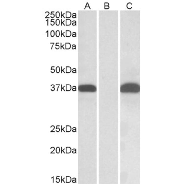 Western Blot - Anti-PIM2 Antibody (A84957) - Antibodies.com