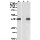 Western Blot - Anti-PIM2 Antibody (A84957) - Antibodies.com