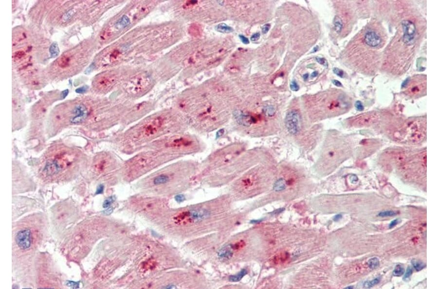 Immunohistochemistry - Anti-PIM2 Antibody (A84957) - Antibodies.com