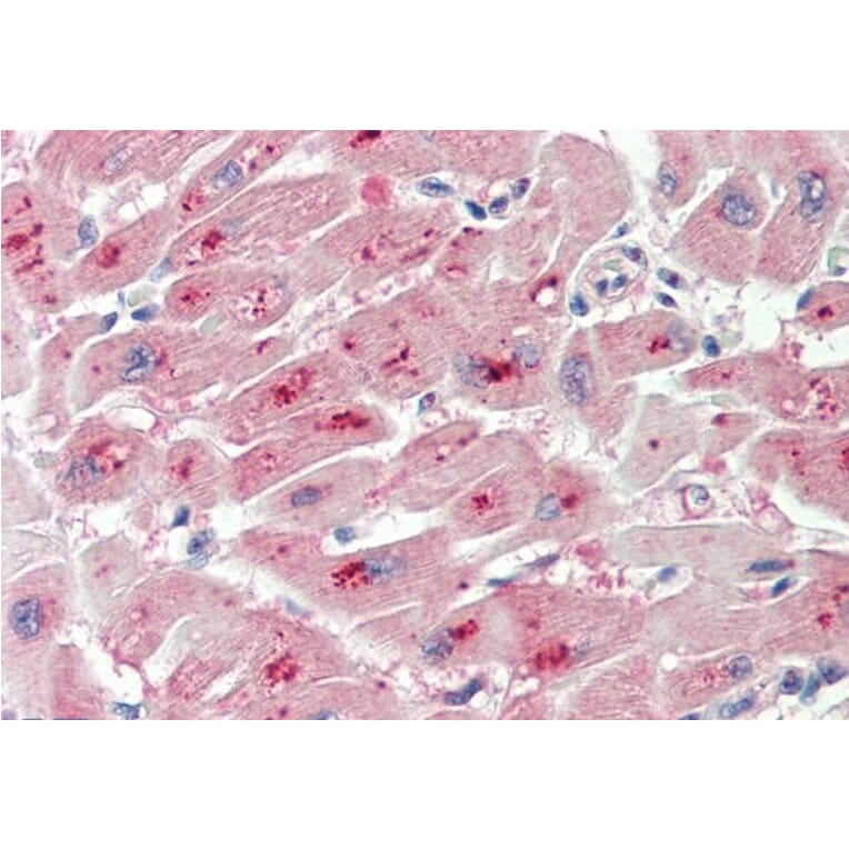 Immunohistochemistry - Anti-PIM2 Antibody (A84957) - Antibodies.com