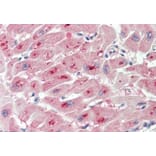 Immunohistochemistry - Anti-PIM2 Antibody (A84957) - Antibodies.com