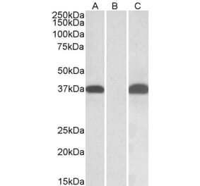 Western Blot - Anti-PIM2 Antibody (A84957) - Antibodies.com