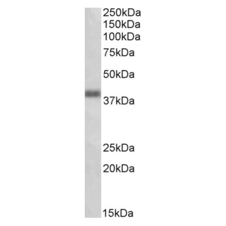 Western Blot - Anti-OXER1 Antibody (A84958) - Antibodies.com