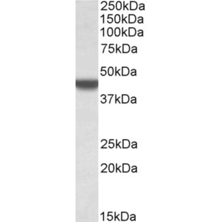 Western Blot - Anti-APOBEC3D Antibody (A84962) - Antibodies.com