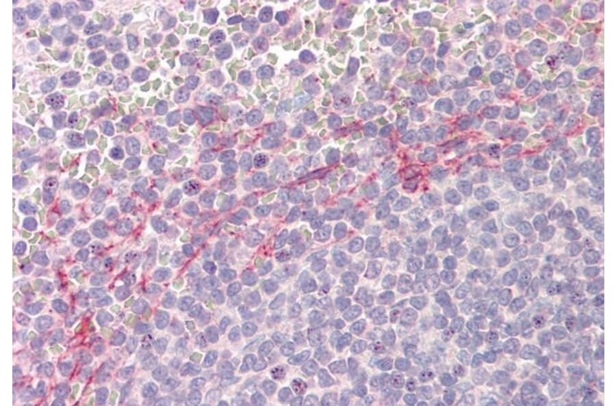 Immunohistochemistry - Anti-APOBEC3D Antibody (A84962) - Antibodies.com