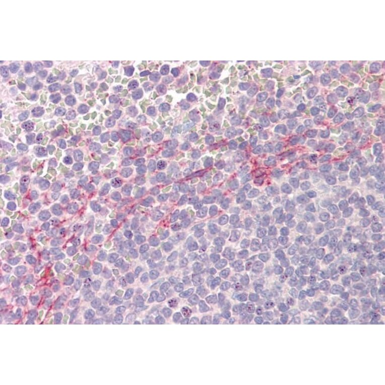 Immunohistochemistry - Anti-APOBEC3D Antibody (A84962) - Antibodies.com