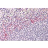 Immunohistochemistry - Anti-APOBEC3D Antibody (A84962) - Antibodies.com