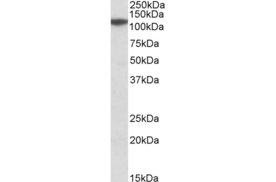 Western Blot - Anti-MTHFD1L Antibody (A84963) - Antibodies.com