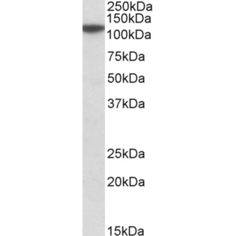 Western Blot - Anti-MTHFD1L Antibody (A84963) - Antibodies.com