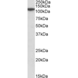 Western Blot - Anti-MTHFD1L Antibody (A84963) - Antibodies.com
