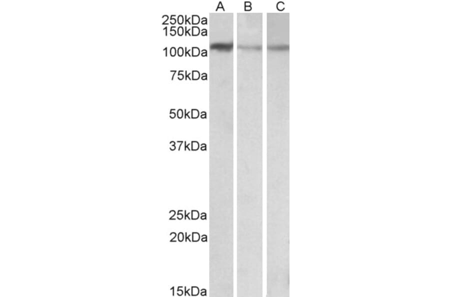Western Blot - Anti-MTHFD1L Antibody (A84963) - Antibodies.com