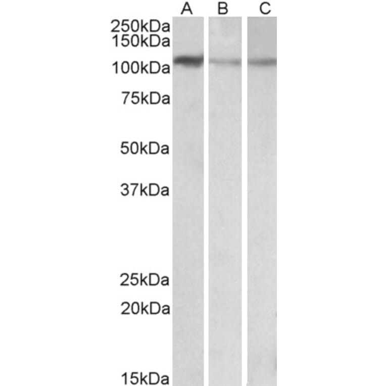Western Blot - Anti-MTHFD1L Antibody (A84963) - Antibodies.com