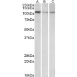 Western Blot - Anti-MTHFD1L Antibody (A84963) - Antibodies.com