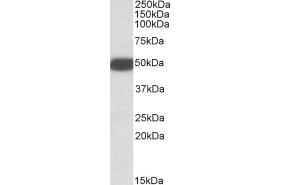 Western Blot - Anti-5HT3B Receptor Antibody (A84964) - Antibodies.com
