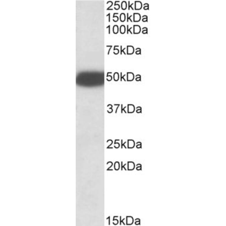 Western Blot - Anti-5HT3B Receptor Antibody (A84964) - Antibodies.com