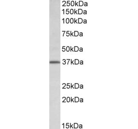 Western Blot - Anti-Tfb2m Antibody (A84966) - Antibodies.com