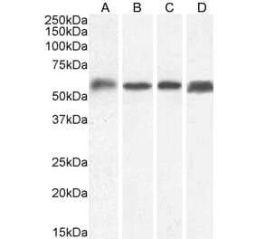 Western Blot - Anti-C22orf28 Antibody (A84969) - Antibodies.com