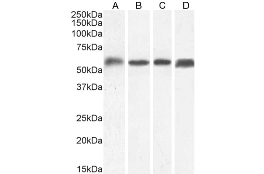 Western Blot - Anti-C22orf28 Antibody (A84969) - Antibodies.com