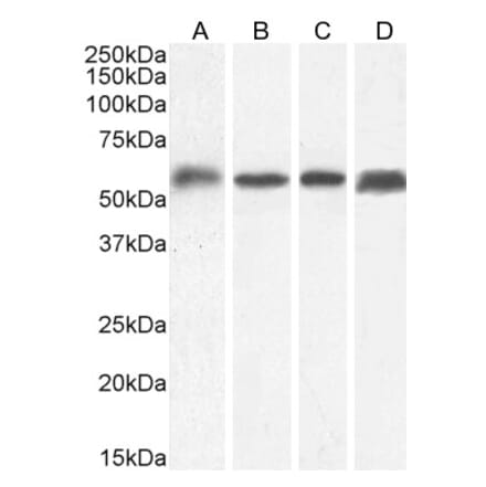 Western Blot - Anti-C22orf28 Antibody (A84969) - Antibodies.com