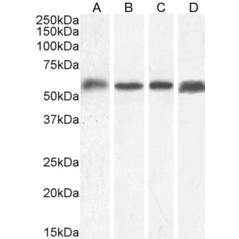Western Blot - Anti-C22orf28 Antibody (A84969) - Antibodies.com