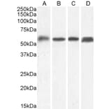Western Blot - Anti-C22orf28 Antibody (A84969) - Antibodies.com