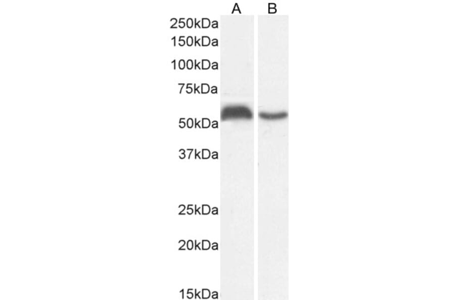 Western Blot - Anti-C22orf28 Antibody (A84969) - Antibodies.com
