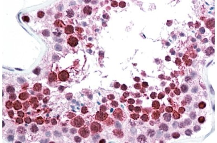 Immunohistochemistry - Anti-C22orf28 Antibody (A84969) - Antibodies.com