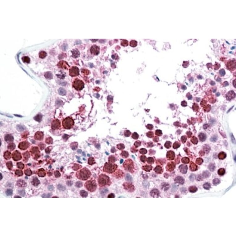 Immunohistochemistry - Anti-C22orf28 Antibody (A84969) - Antibodies.com