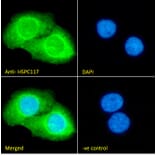 Immunofluorescence - Anti-C22orf28 Antibody (A84969) - Antibodies.com