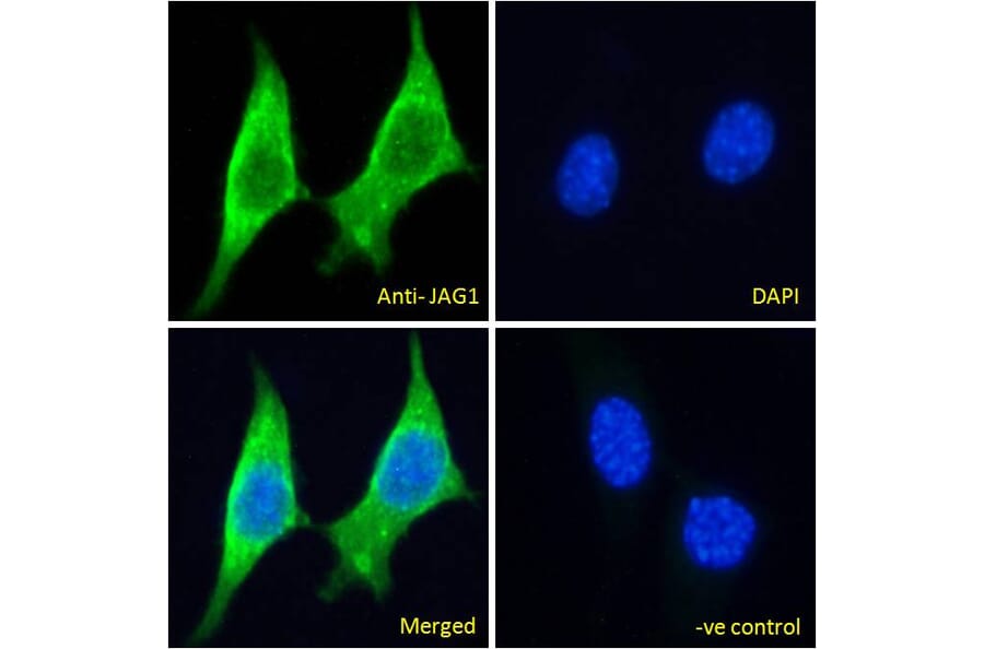 Immunofluorescence - Anti-Jagged1 Antibody (A84972) - Antibodies.com