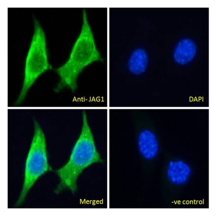 Immunofluorescence - Anti-Jagged1 Antibody (A84972) - Antibodies.com