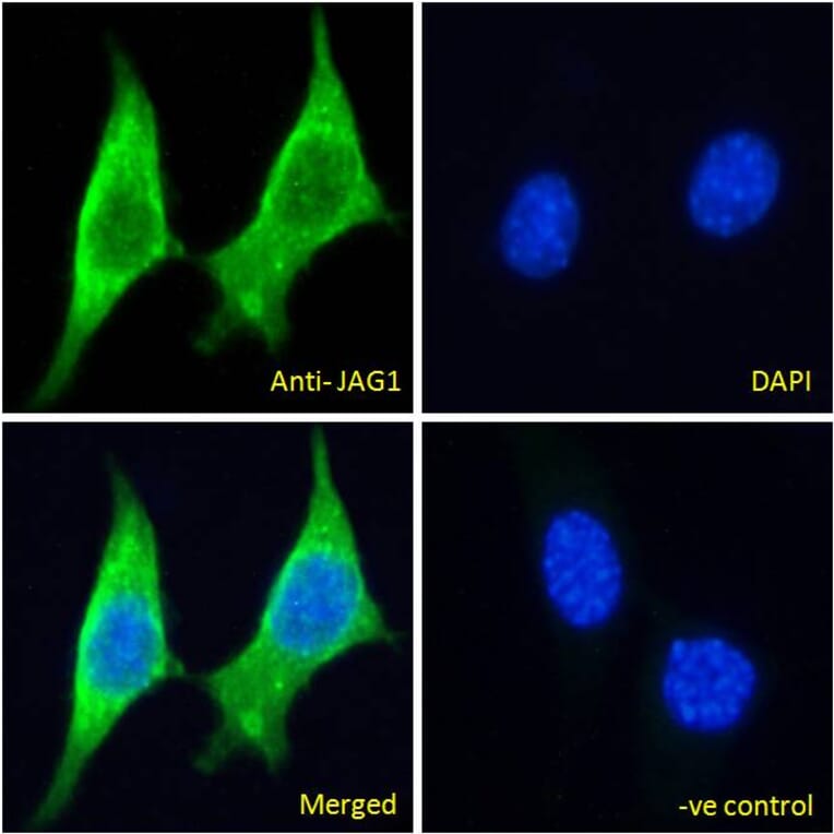 Immunofluorescence - Anti-Jagged1 Antibody (A84972) - Antibodies.com